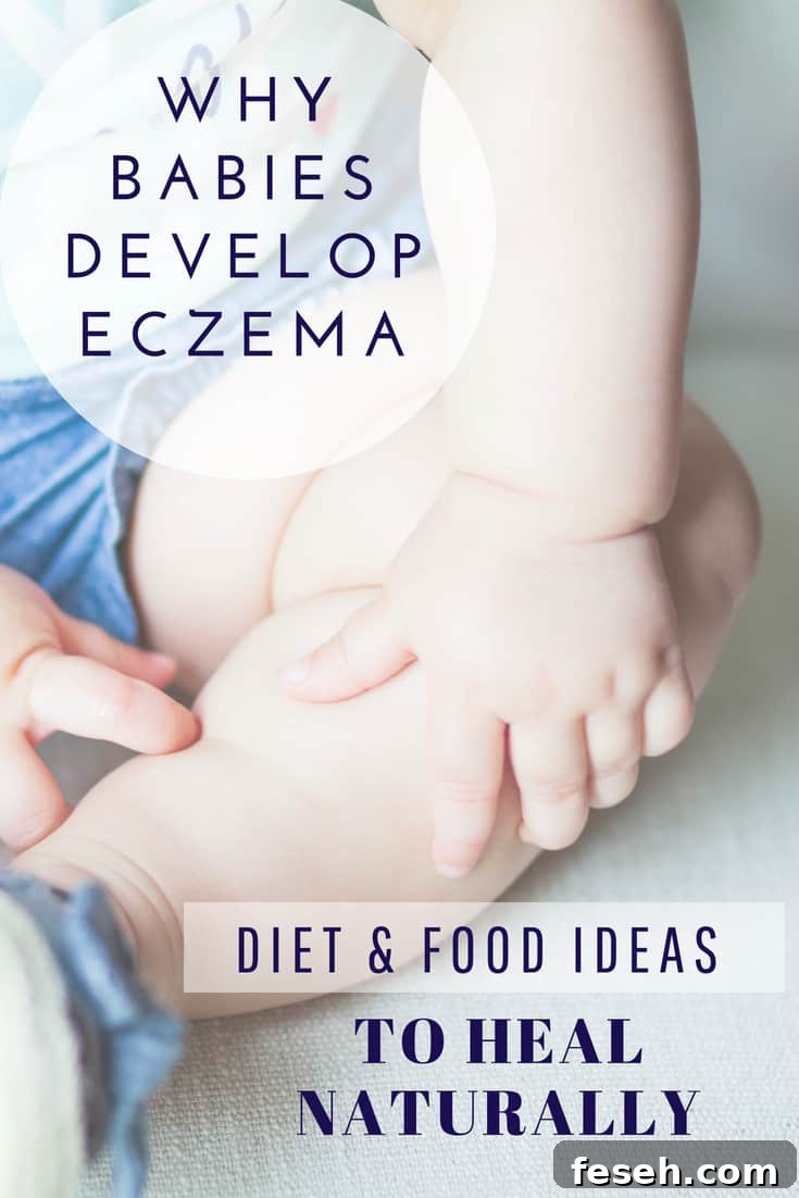 Baby Eczema Causes and Triggers, Diet And Food Recipe Ideas To Heal Naturally (Including for nursing mothers, Infants, and Toddlers ). Learn more about baby eczema and gut connection. #healthyeating #naturalremedies #eczema #babyfood #baby